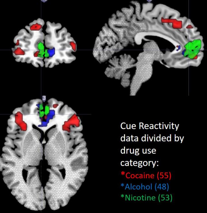 Topography of the Brain [IMAGE] EurekAlert! Science News Releases