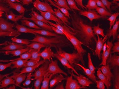 Softening Arteries, Protecting the Heart