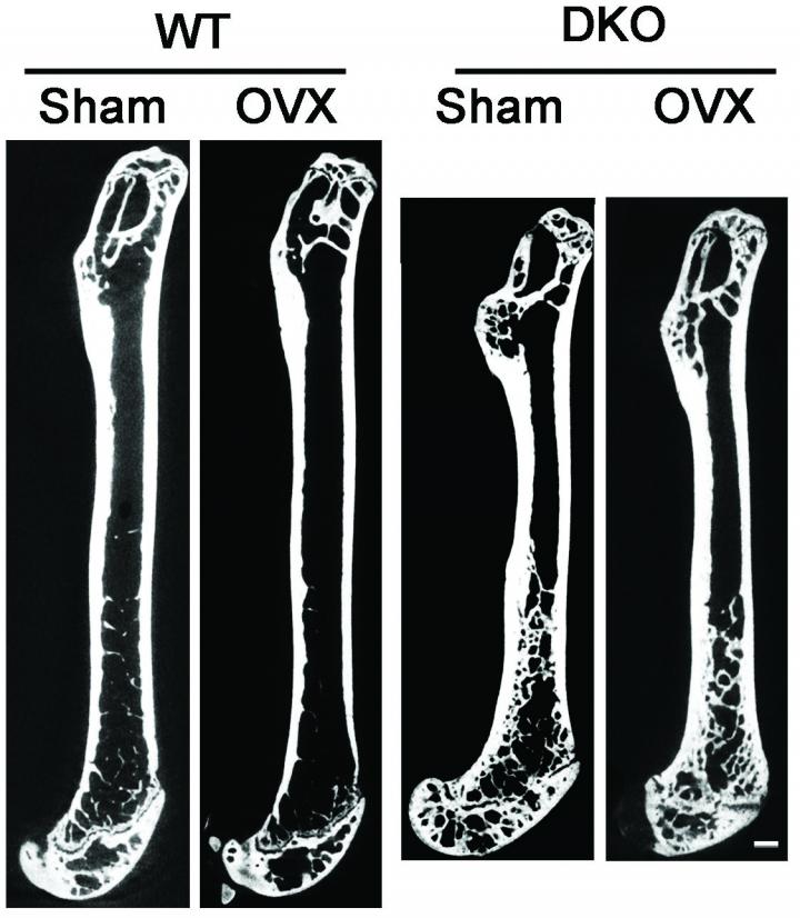 Hampering Bone Breakdown Protects Bone Health EurekAlert!
