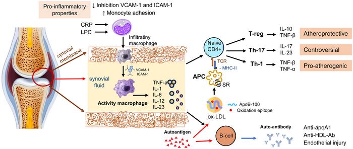 The influence of pro-inflammatory cytokines on lipid metabolism and the pro-atherogenic potential of immune cells in RA