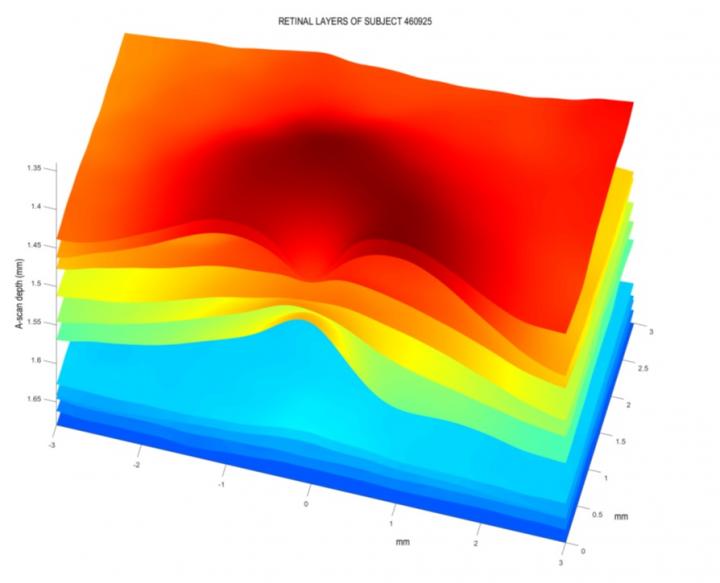 Retinal Layers