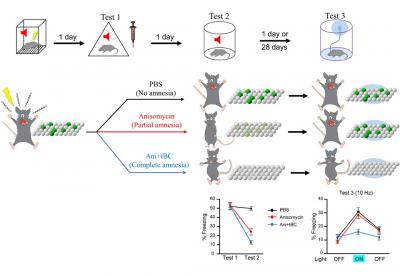 Figure 1: Complete Retrograde Amnesia