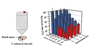 New Plasma Jet Technology Effectively Treats Fungal Nail Infections