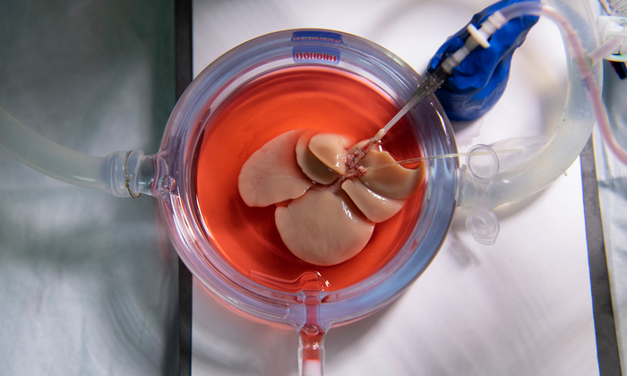 Rat Liver Being Loaded with Cryoprotective Agents