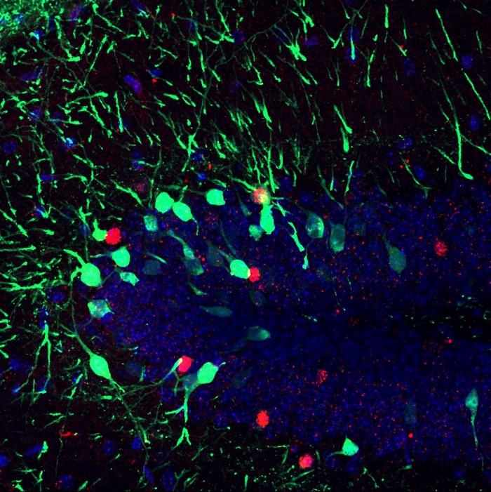 Can Memory Manipulation Help Treat Alcohol Addiction?