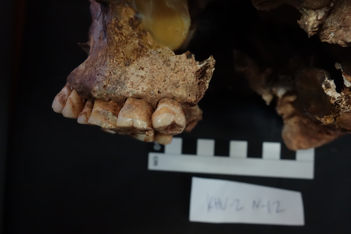 Sampled upper jaw