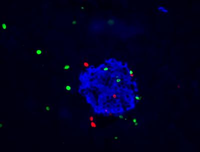 The Stem Cells That Weren't There