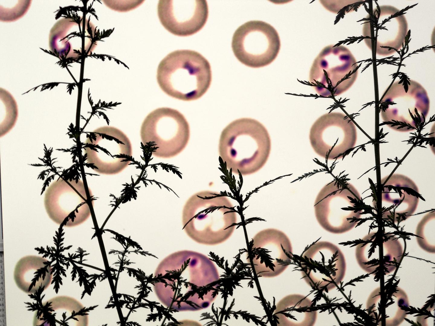 <i>Artemisia annua</i> and a Thin Blood Smear, Stained
