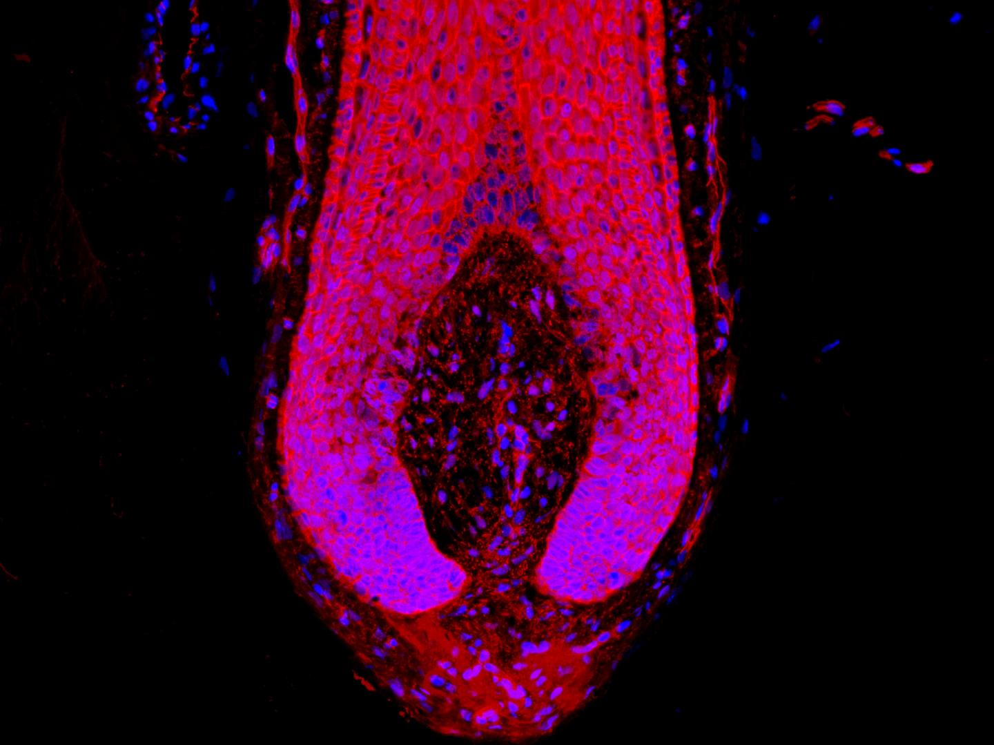 Fringe Benefits: Side Effects of a Common Immunosuppressant Lead Researchers to Possible Treatment