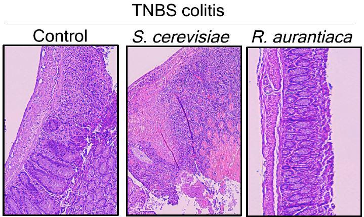 Yeast Brew Trouble for Inflammatory Bowel Disorders