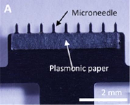 Painless Skin Patch Collects Fluid for Diagnostic Testing
