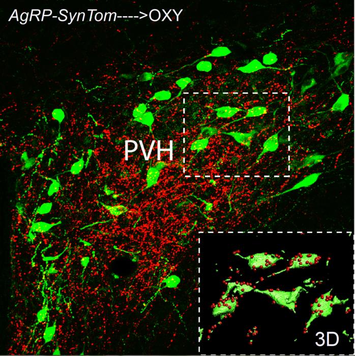 AgRP neurons