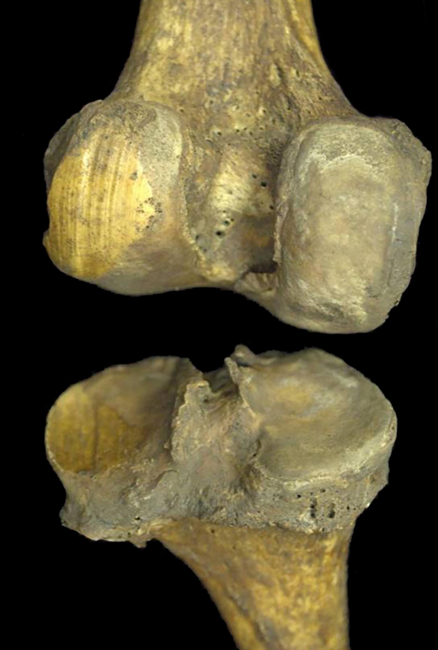 An Archaeological Sample with Traces of Bone-on-Bone Contact