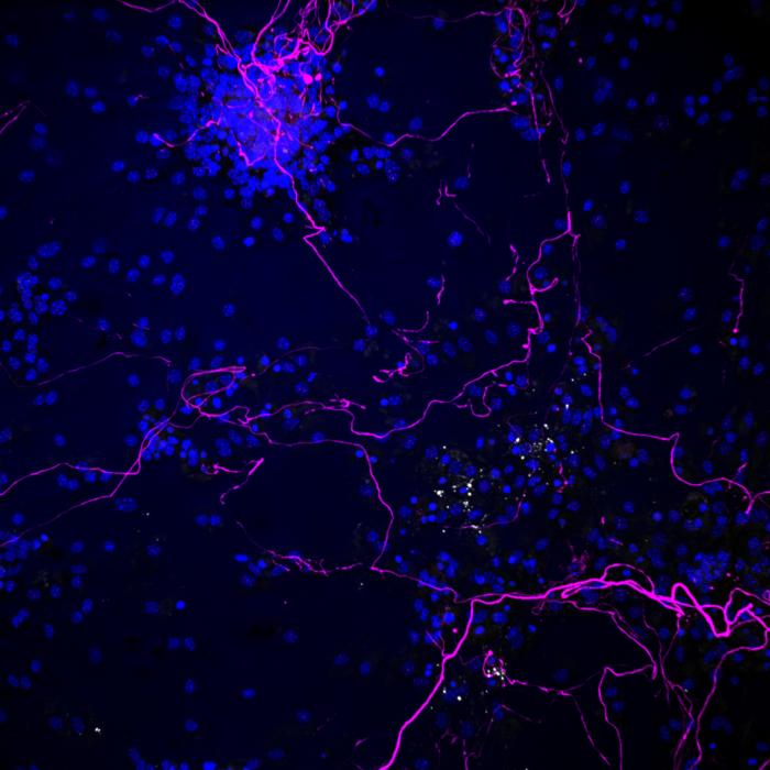 nerve fibers and oligodendrocytes treated with IL-12