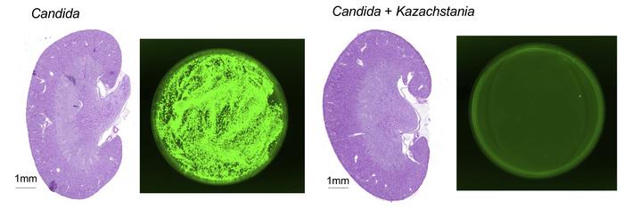 K. weizmannii mitigates invasive candidiasis in immunosuppressed mice