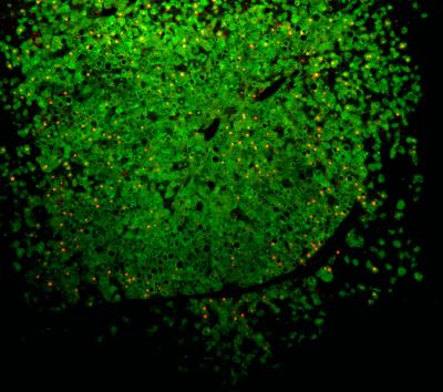 The Mouse with a Human Liver: A New Model for the Treatment of Liver Disease