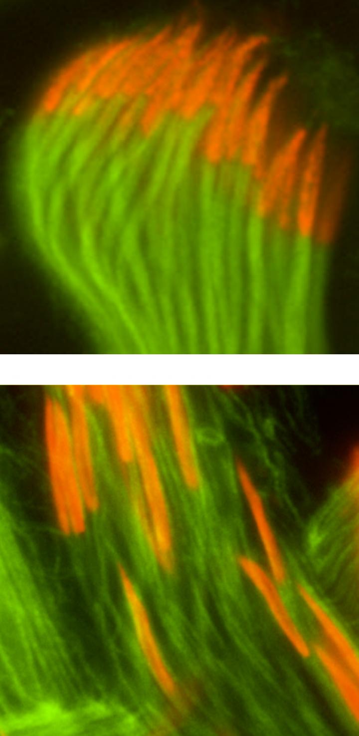 <em>Drosophila melanogaster</em> Spermatozoa