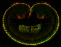 Inner Ear Injected with AAV8 Virus Producing GFP and the SANS Protein