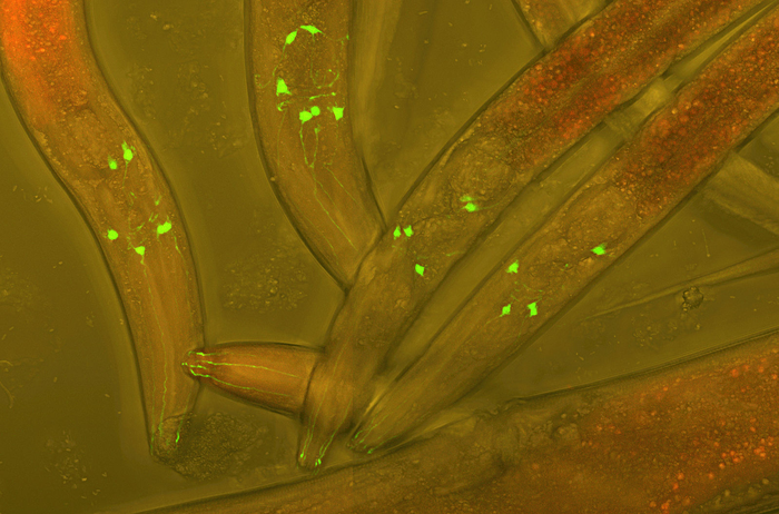 C Elegans with neurons visible with GFP
