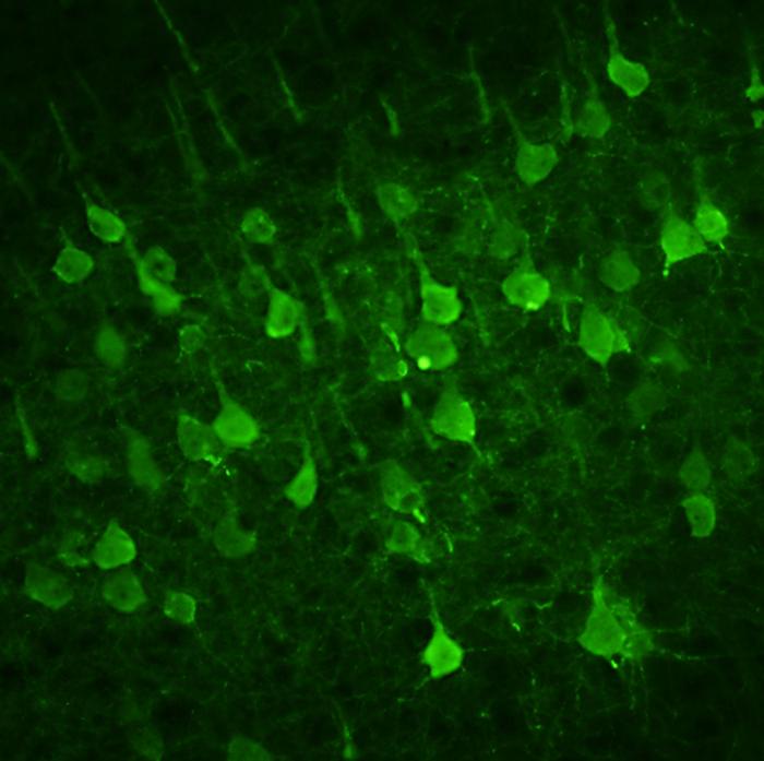 TDP-43—a pathogenic protein—exhibits distinct neurological spreading patterns in amyotrophic lateral sclerosis (ALS)