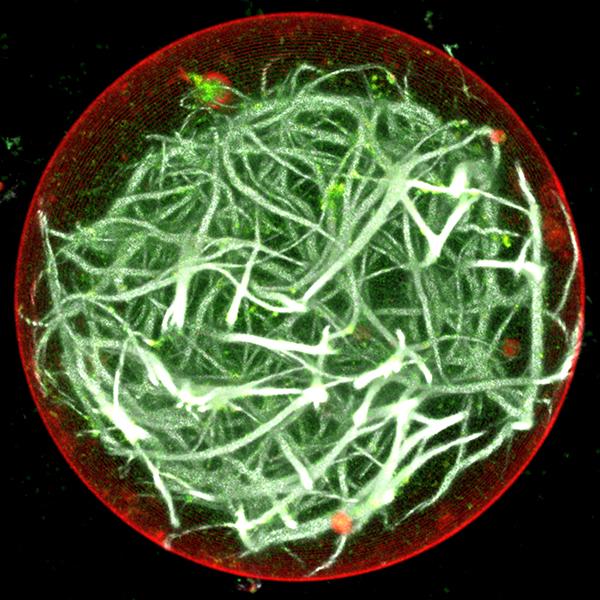 Artificial Cell-Like System