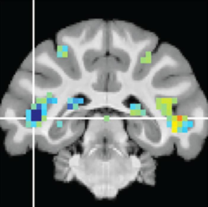 fSTS region in the brain