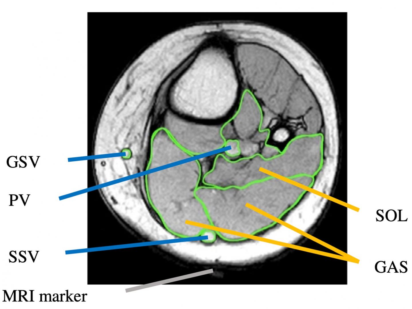 Figure1