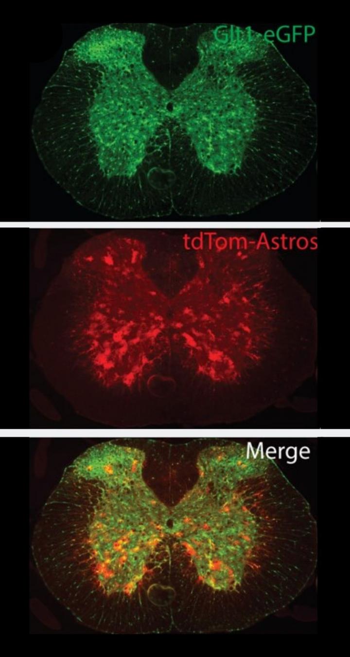 Astrocytes