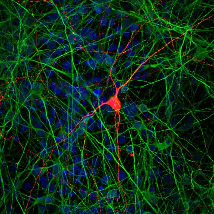 CA3 Neurons