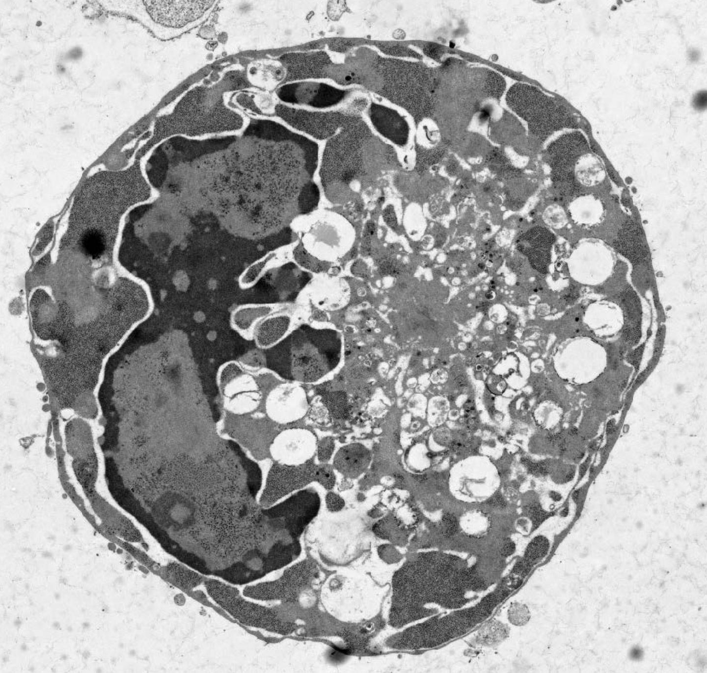 poliomyelitis cell