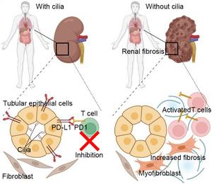 The role of autoinflammation in ciliopathies