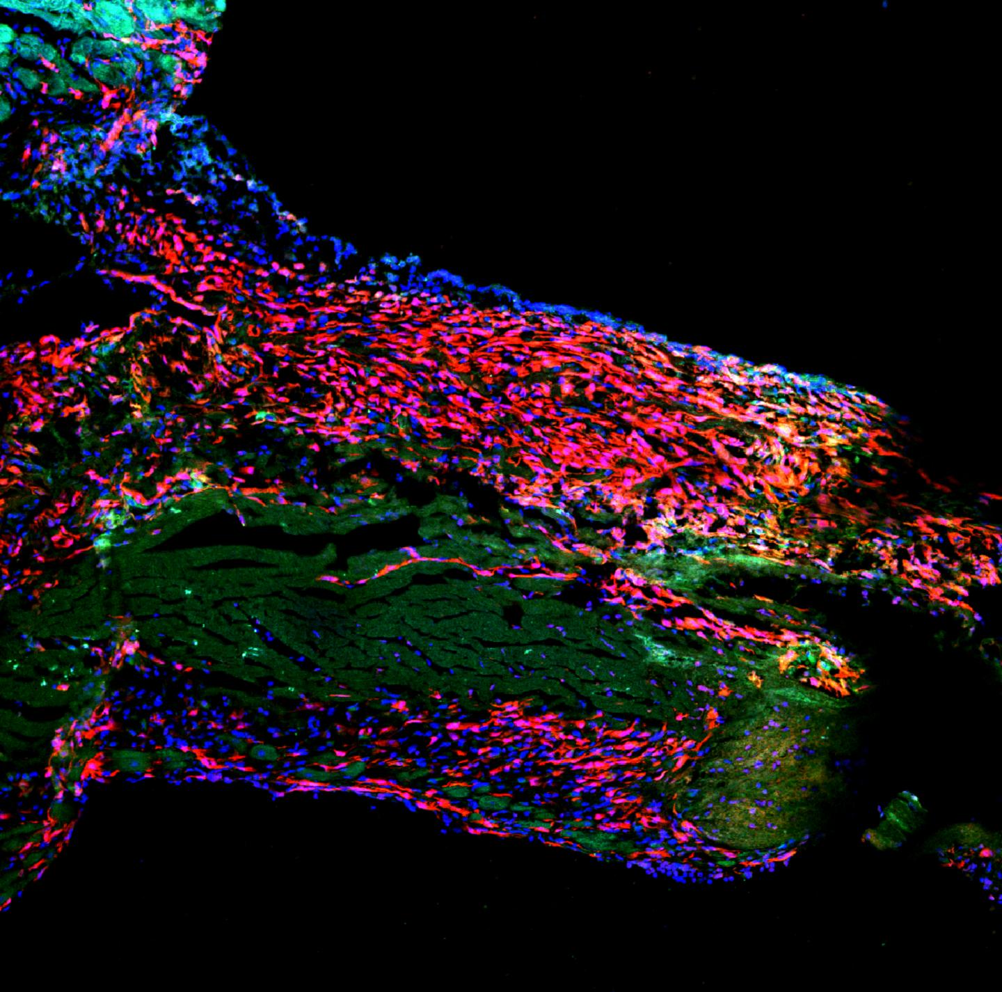 The Heart Wall with the sSar (Red) and Dead Heart Muscle Cells (Pale Green)