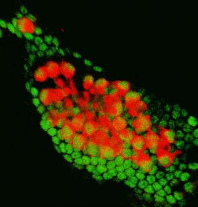 Induced Ear Sensory Patch