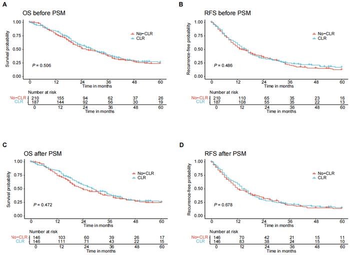 Figure 2. Kaplan-Meier survival curve. According to whether the caudate lobe of the liver was resected, patients with hilar cholangiocarcinoma were divided into two groups. Before and after propensity score matching (PSM), there was no statistically signi