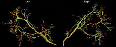 Connectomes of a Left-Right Pair of Interscutularis Muscles