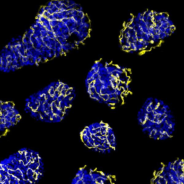 PTP1B Phosphatase Activity