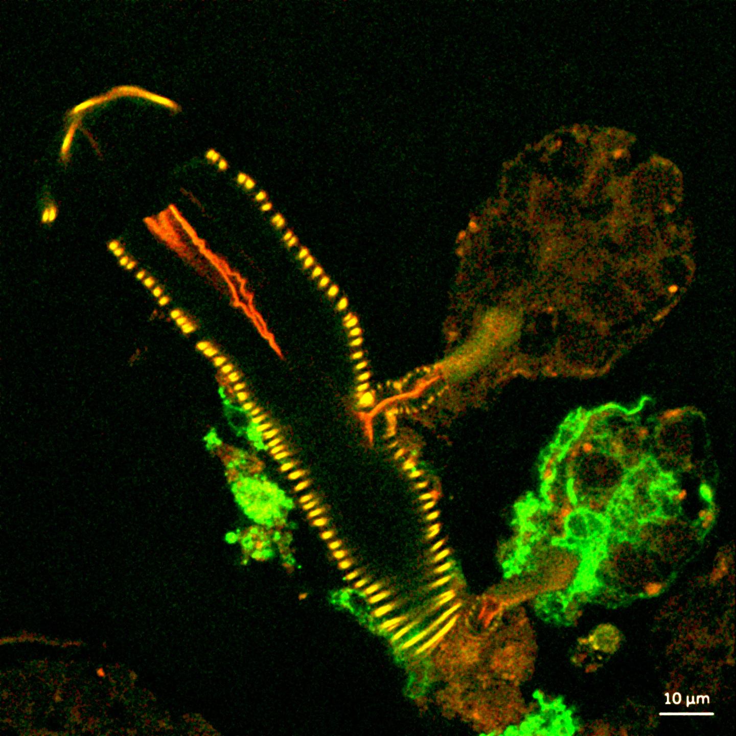 Cross Section of a Tick Salivary Gland Infected with Langat Virus