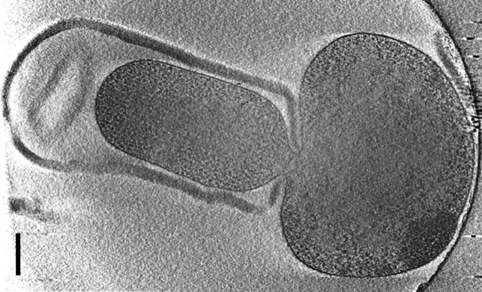 Listeria bacterium losing its cell wall