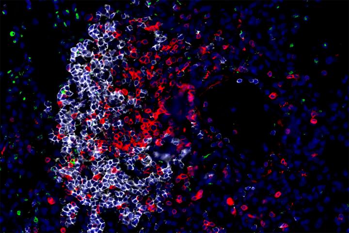 Innate and Immune Cells in the Lung