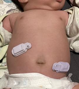 Devices on a baby
