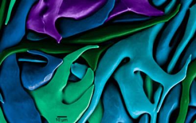 Biomineral Crystals Found in a Sea Urchin Tooth