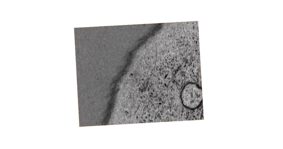 Focused ion beam-scanning electron microscopy (FIB-SEM) reveals the association of Endoplasmic Reticulum �C Mitochondrial contact sites and known contact site-associated biology
