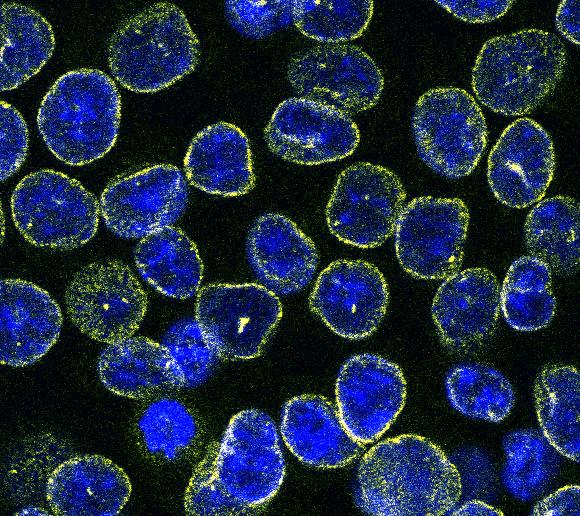 Nuclear Gatekeeper Could Block Undruggable Prostate Cancer Targets