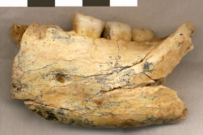 Human Jaw Bone