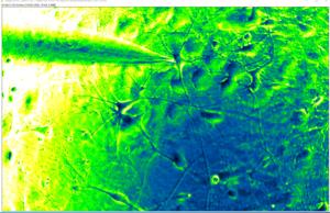 Scripps Research scientists uncover new molecular drivers of Alzheimer’s