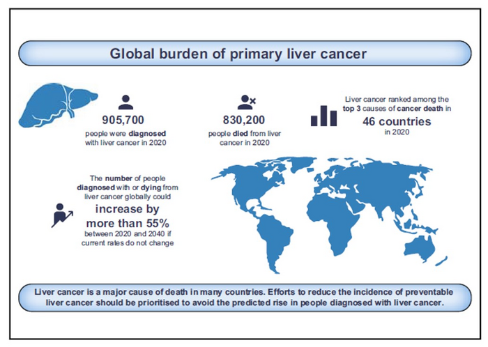 Global burden of primary liver cancer