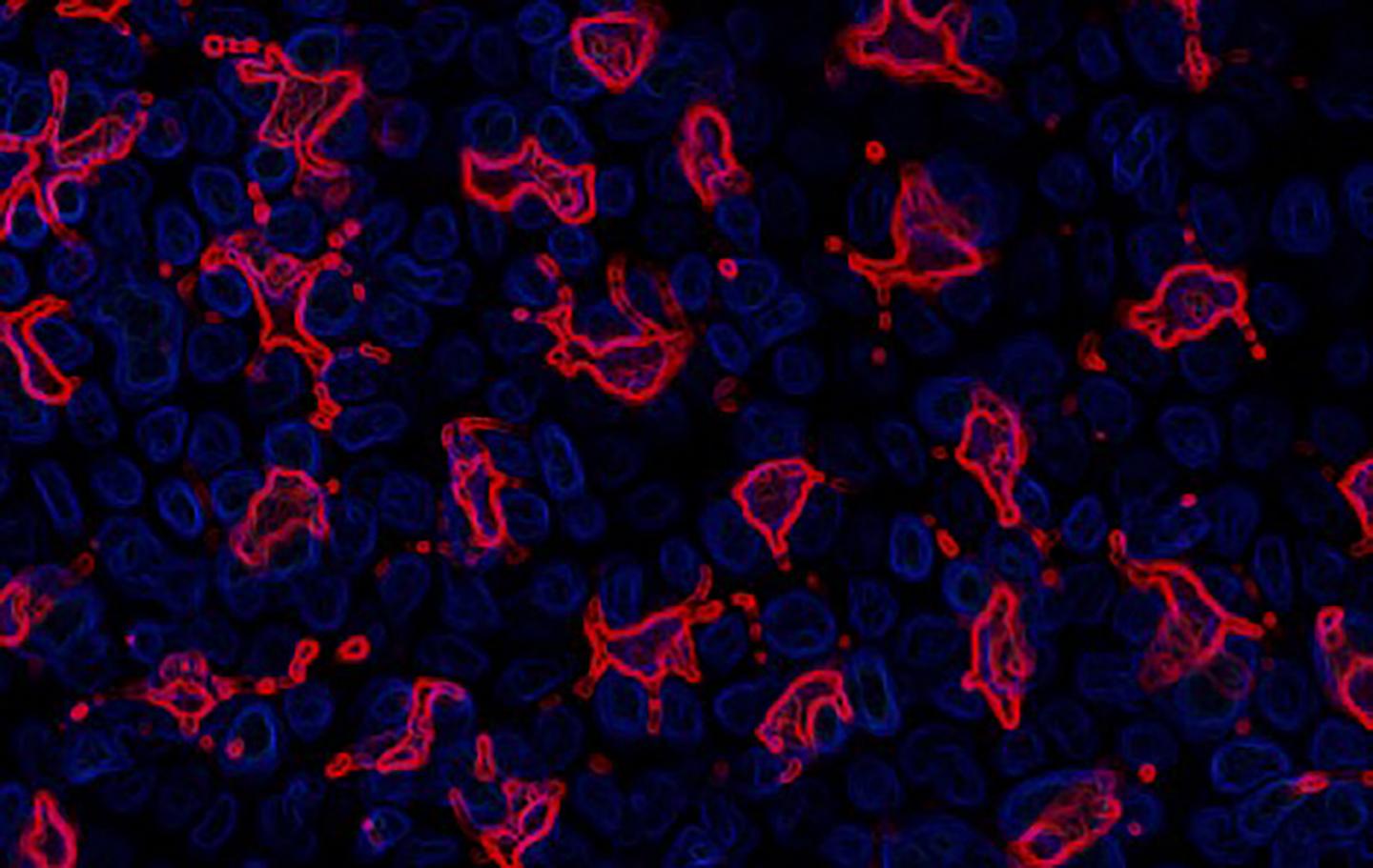 A Cellular Partnership Breaks Down in Lupus ( | EurekAlert!