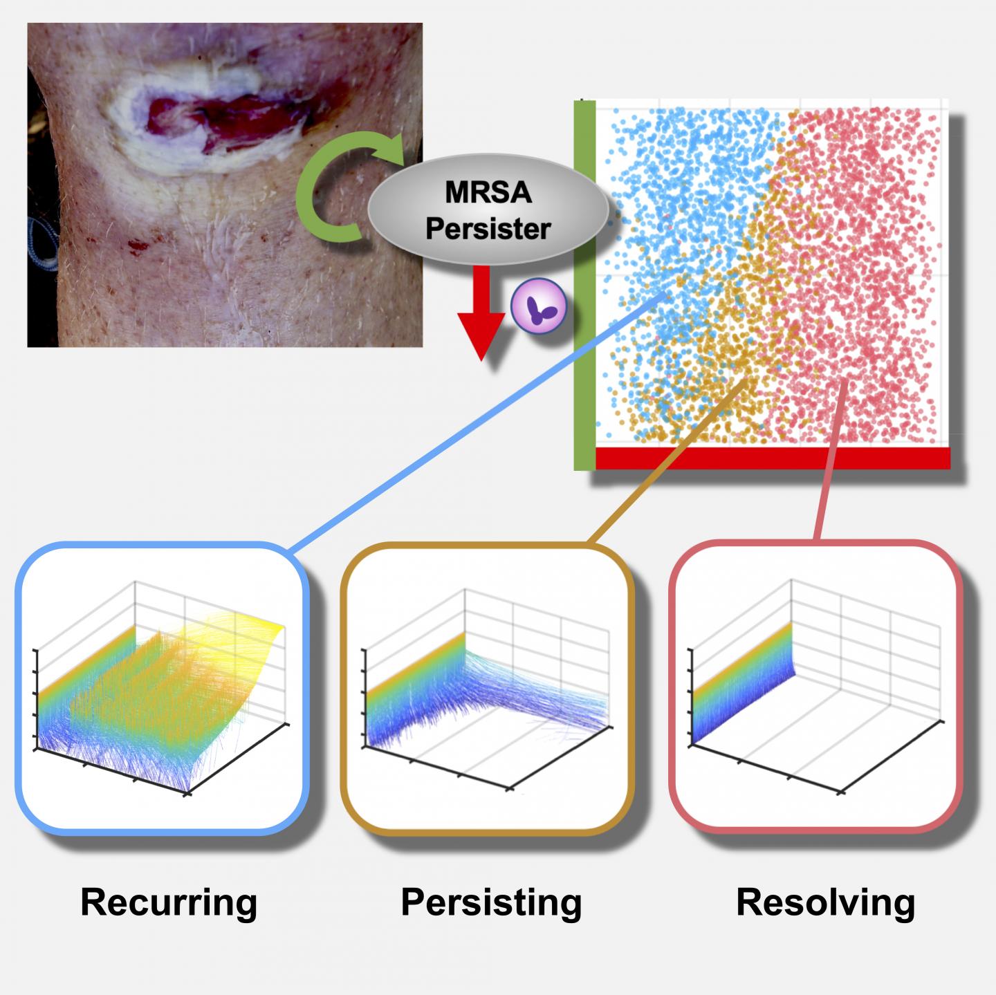Immune System Effectiveness Appears Key to Antibiotic Success Against Persistent Bacteria