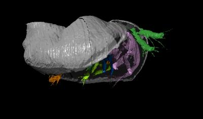 <i>Pauline avibella</i> Oblique Frontal View