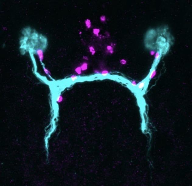 Planarian Visual System with Guidepost-Like Cells